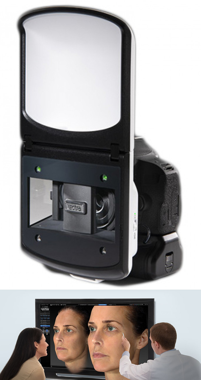 ベクトラVECTRA H2