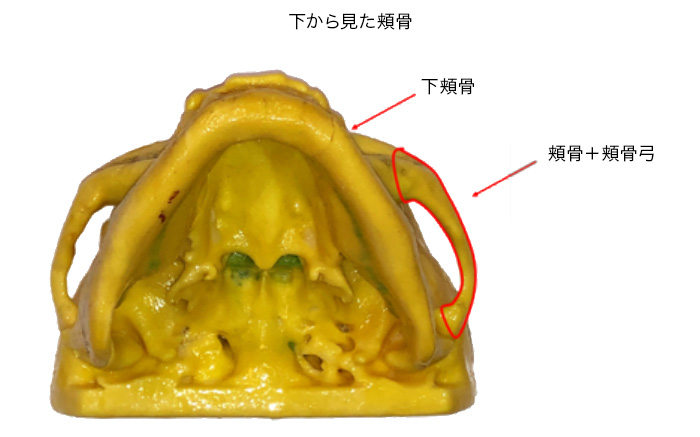 頬骨を下から見た写真をお見せします