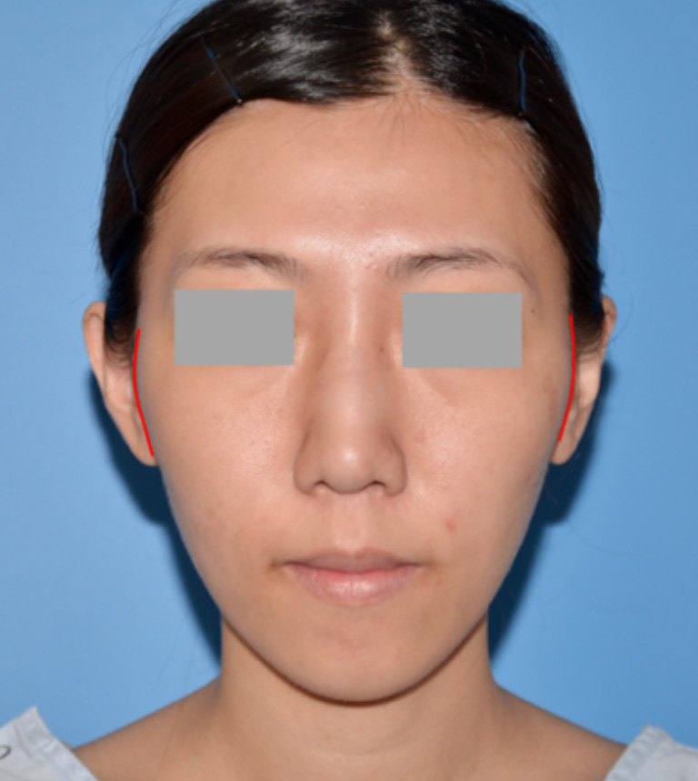 顔の横幅が広い方