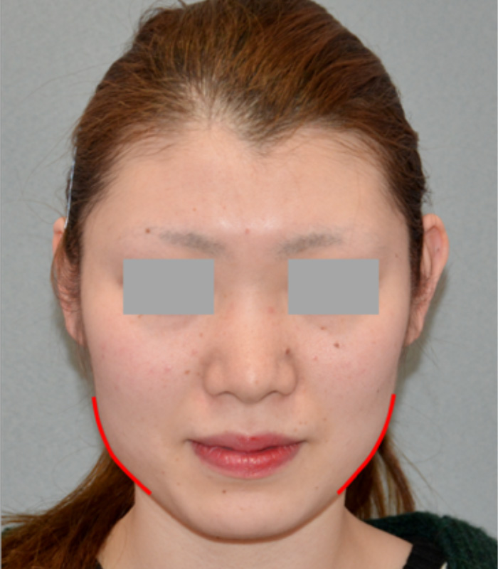 顔がホームベース型、やや大きい方