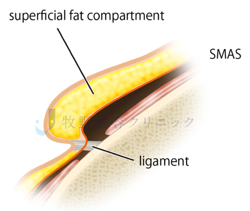 カニューラの種類