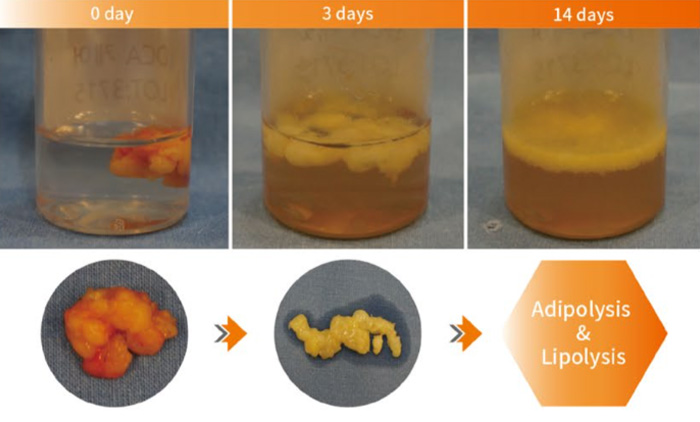 治療に適している部位
