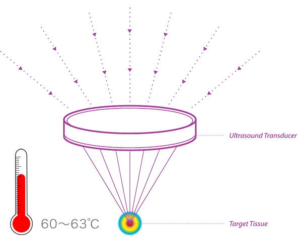 中心部はおよそ60〜65度に熱せられます