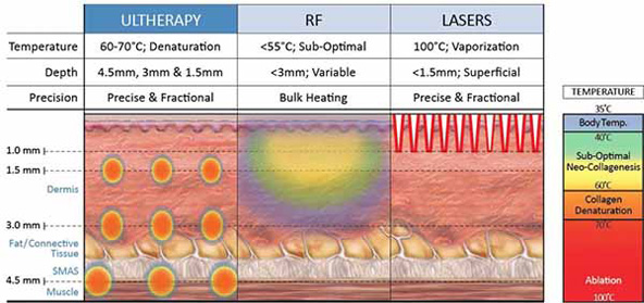 ウルトラセルが熱している様子